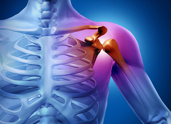 Luxaciones de Hombro